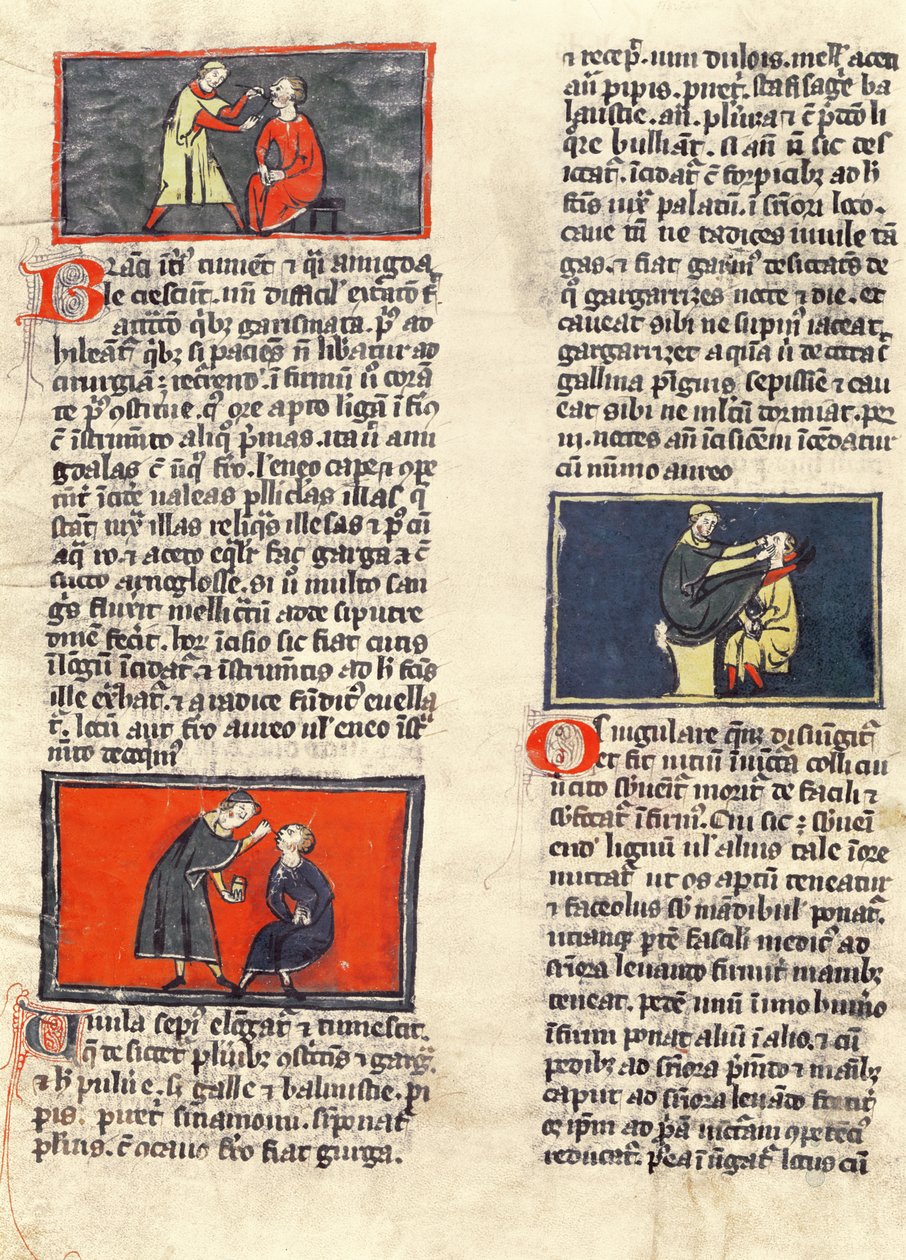 Pani H 89 fol.16v Chirurgia Stomatologiczna, z wydania „Księgi Chirurgii” Rogiera de Salerne autorstwa French School