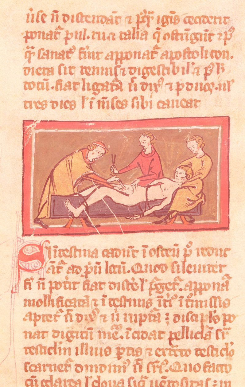 Ms H 89 fol.23 Chirurgia, z wydania Księgi Chirurgii Rogiera de Salerne autorstwa French School