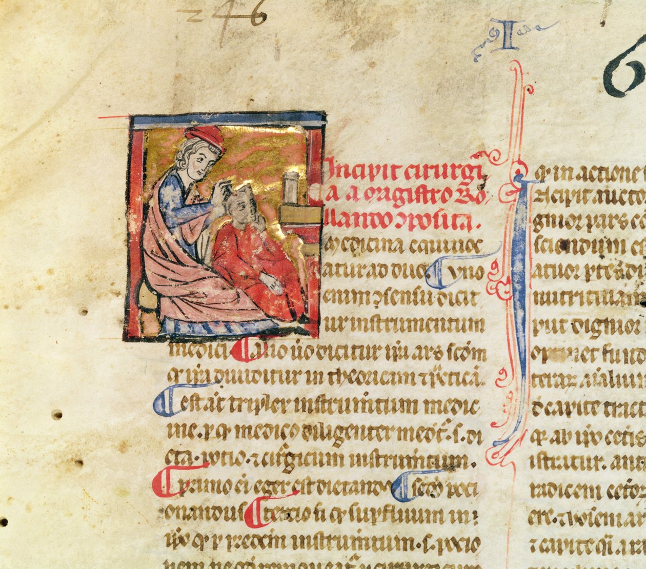 Pani Lat. 7134 fol.1 Trepanacja, z Chirurgii Maitre Rolandi autorstwa French School