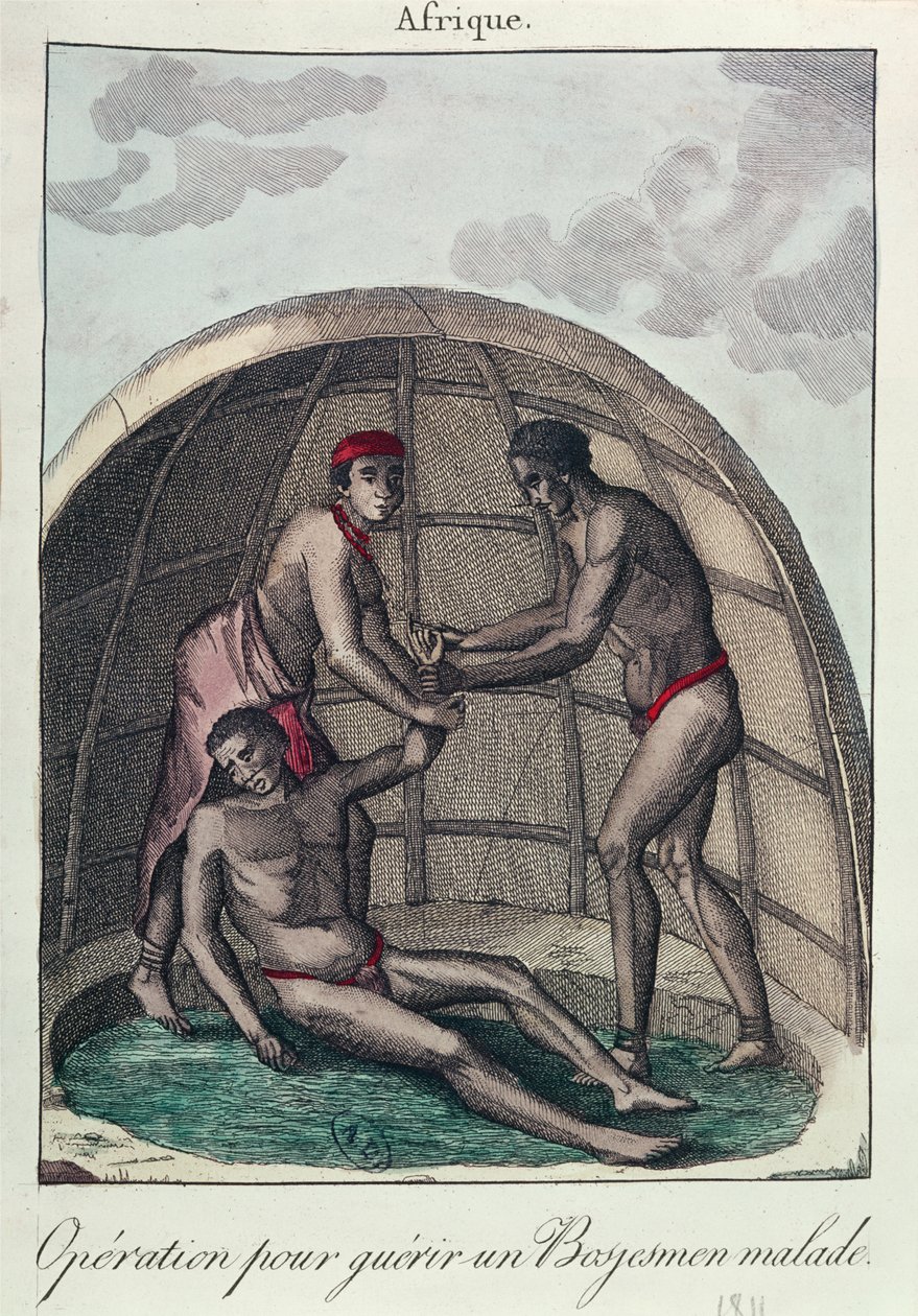 Operacja uzdrowienia chorego Buszmana, 1811 (kolorowe grawerowanie) autorstwa French School