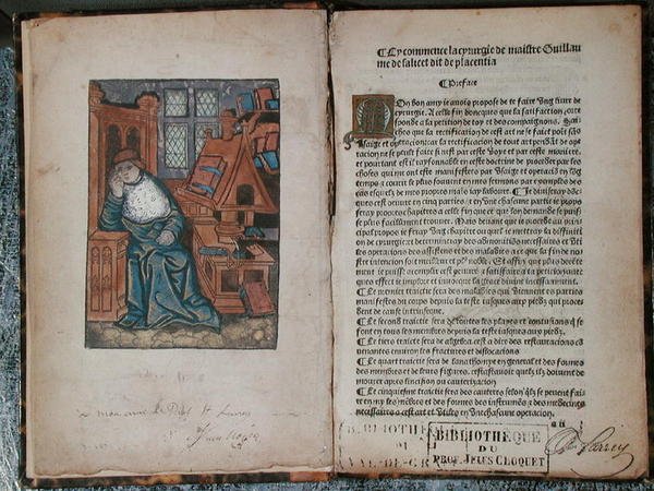 Strona z „La Cyrurgie de Maistre Guillaume de Salicet”, Paryż autorstwa French School