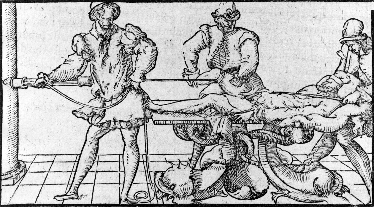 Redukcja zwichnięć, -w „Traktacie Medycznym Ambroise Paré”, ok. 1560. autorstwa French School