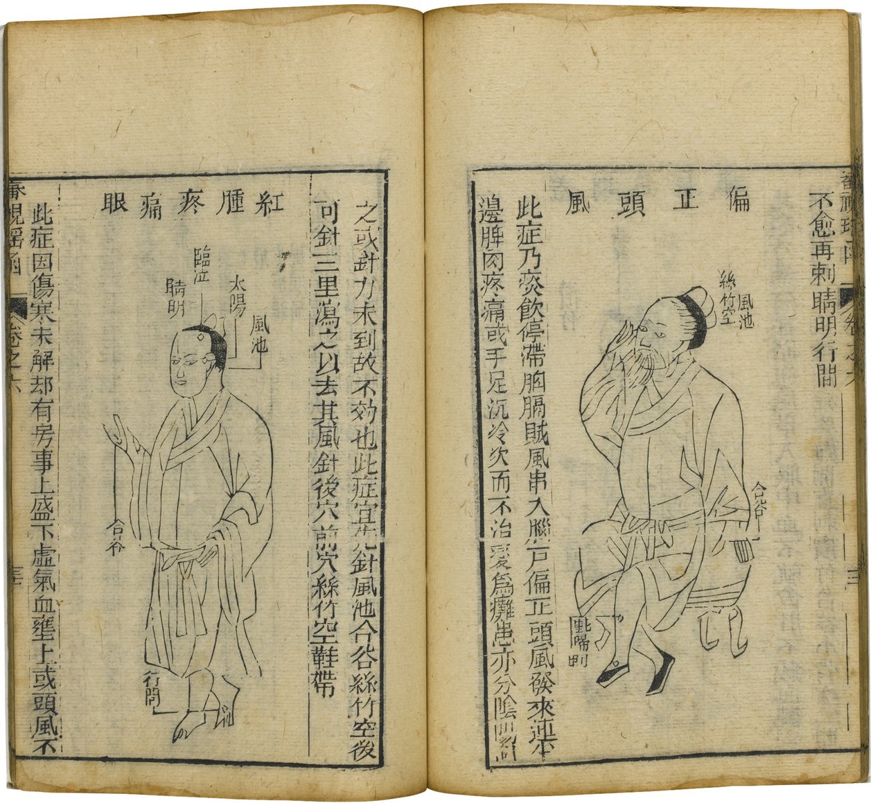 Shen Shi Yao Han Cenna księga okulistyki, 1644 autorstwa Fu Renyu