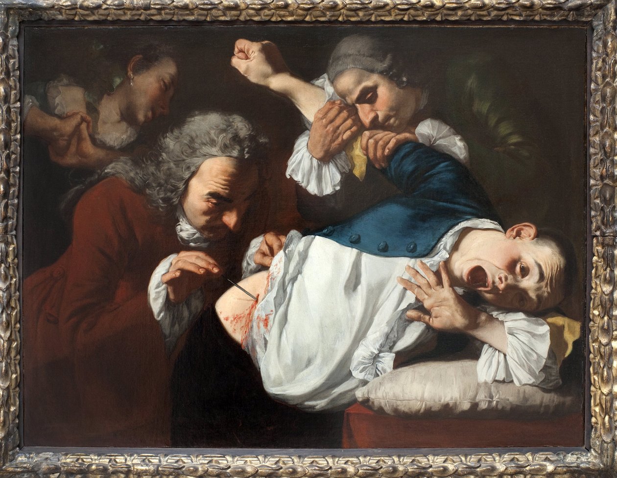 Operacja. Obraz Gaspare Traversi (ok. 1722-1770), olej na płótnie, ok. 201 1753-1754. Sztuka włoska XVIII wieku. Staatsgalerie Stuttgart (Niemcy). autorstwa Gaspare Traversi