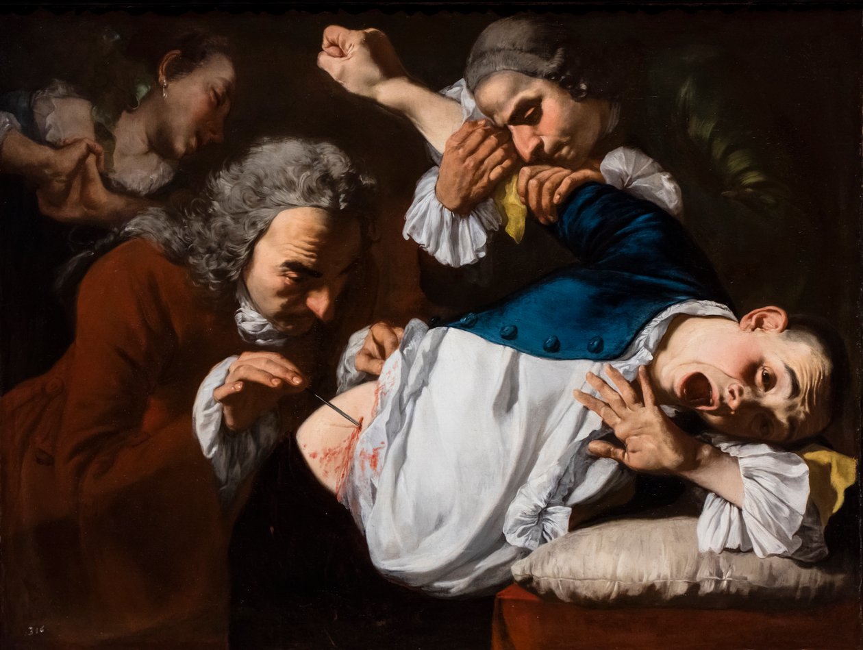 Operacja, około 1753/54 (olej na płótnie) autorstwa Gaspare Traversi