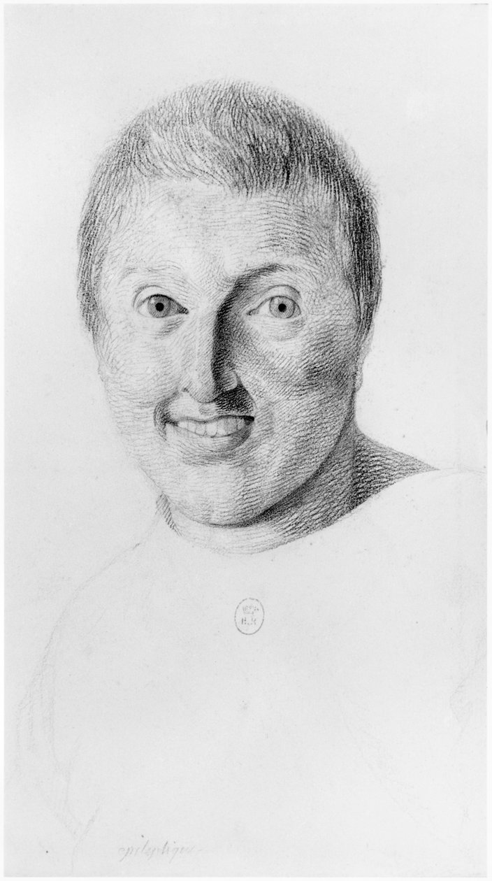 Kobieta cierpiąca na epilepsję, widok z przodu, ilustracja z niepublikowanego traktatu Jeana Etienne Dominique Esquirol (1772-1840) o szaleńcach z przytułku Salpetriere, ok. 1818 r. autorstwa Georges Francois Gabriel