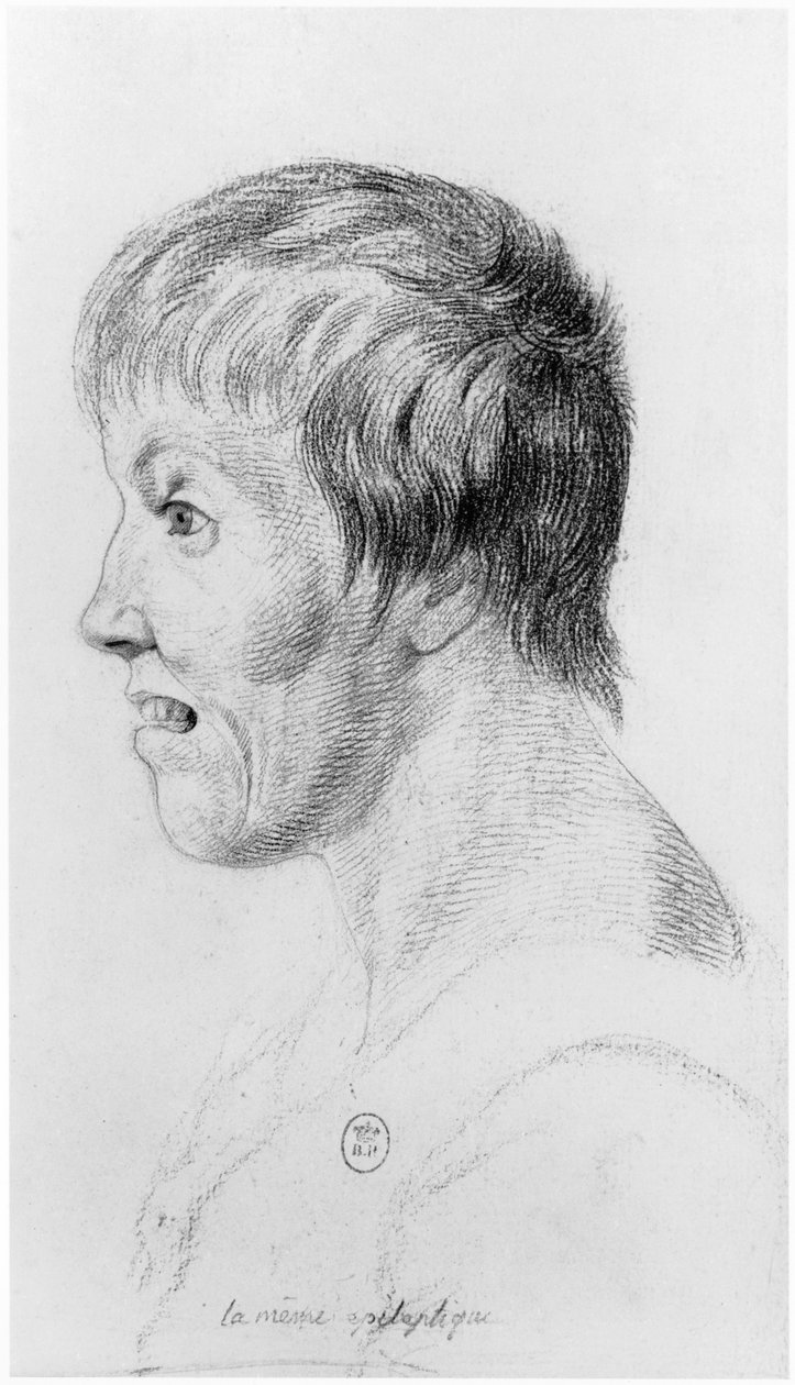 Kobieta z padaczką, profil, ilustracja z niepublikowanego traktatu Jeana Etienne Dominique Esquirola (1772-1840) na temat wariatów z przytułku Salpetriere, ok. 1818 autorstwa Georges Francois Gabriel