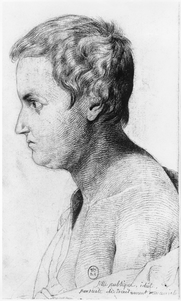 Idiotyczna prostytutka chora na syfilis, ilustracja z nieopublikowanego traktatu Jeana Etienne Dominique Esquirola (1772-1840) o wariatach z przytułku Salpetriere, ok. 1818 autorstwa Georges Francois Gabriel