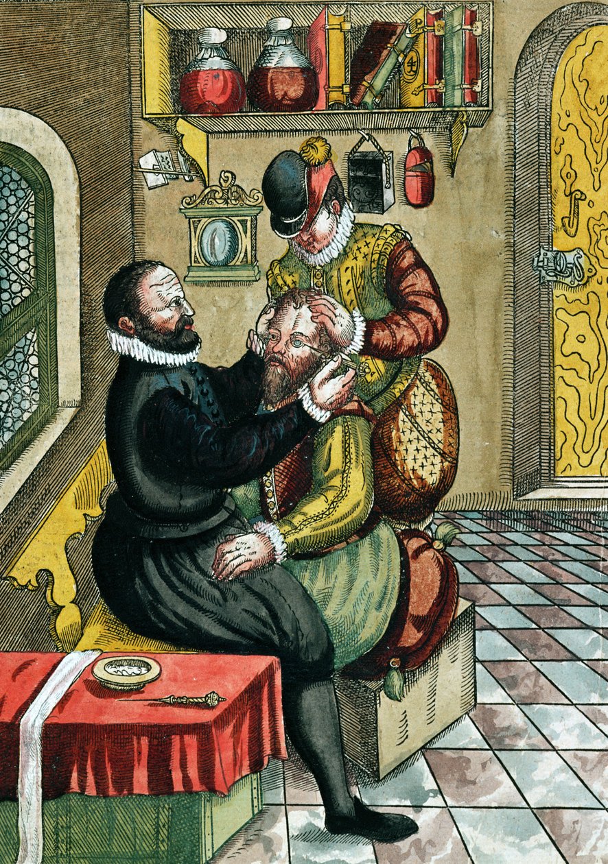 Operacja zaćmy, z Ophthalmodouleia Georga Bartischa (1535-1636) wydana w Dreźnie w 1583 r. (kolorowy drzeworyt) autorstwa German School