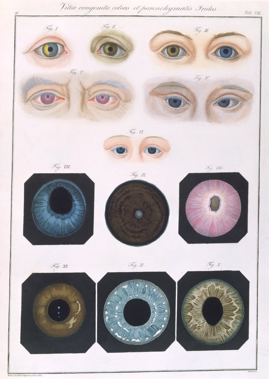 Opis wrodzonych anomalii oka, z Obrazów klinicznych chorób i wad wzroku ludzkiego oka, Friedrich August von Ammon (1799-1861) 1838 autorstwa German School