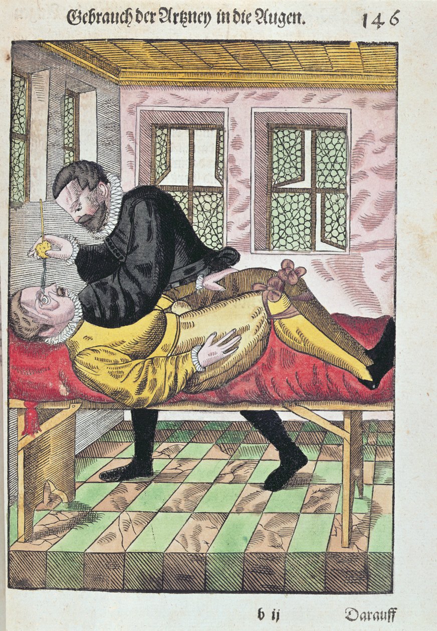 Operacja oka z Ophthalmodouleia Georga Bartischa (1535-1636) wydana w Dreźnie w 1583 r. (kolorowy drzeworyt) autorstwa German School