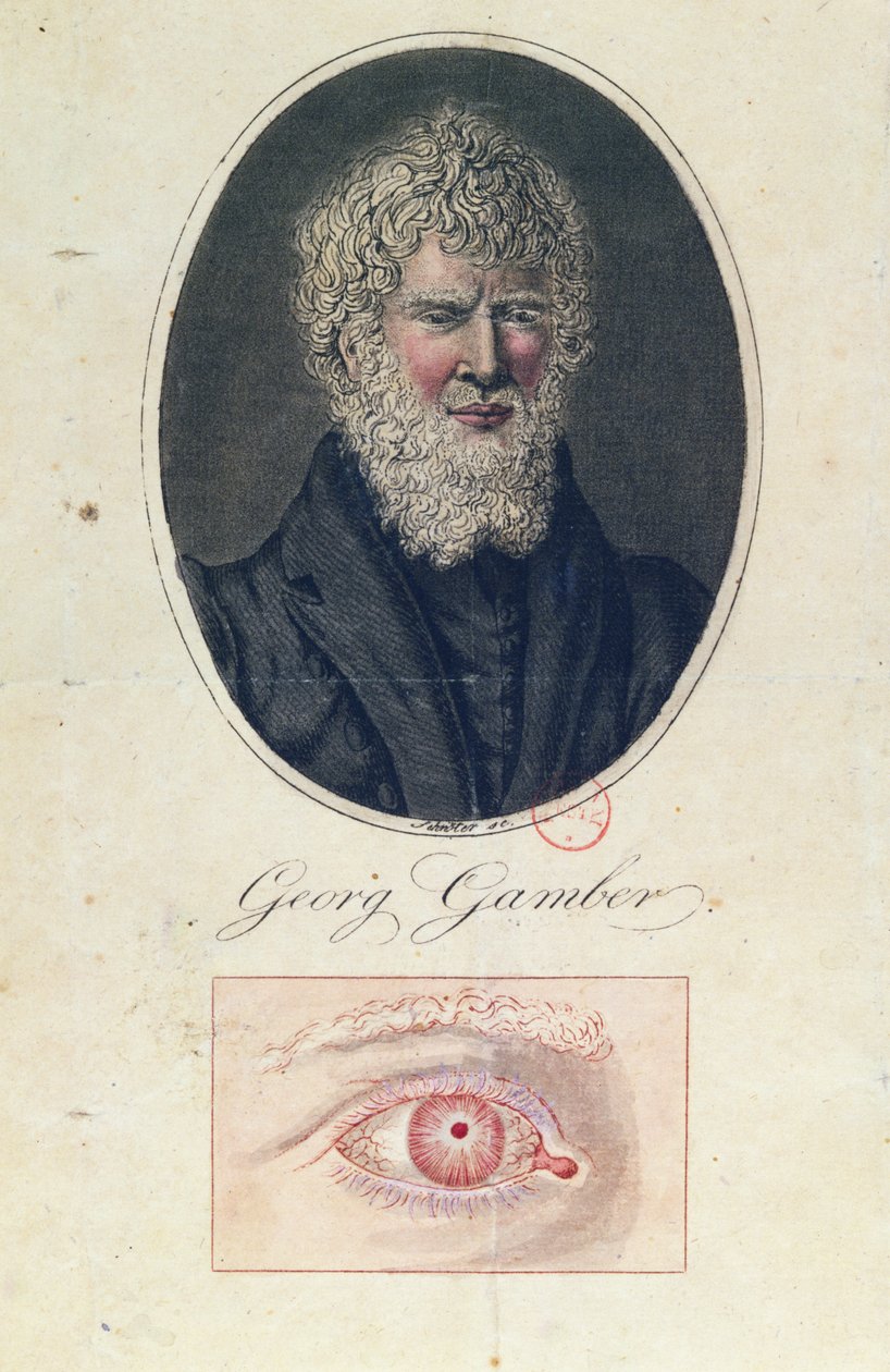 Georg Gamber, albinos autorstwa German School