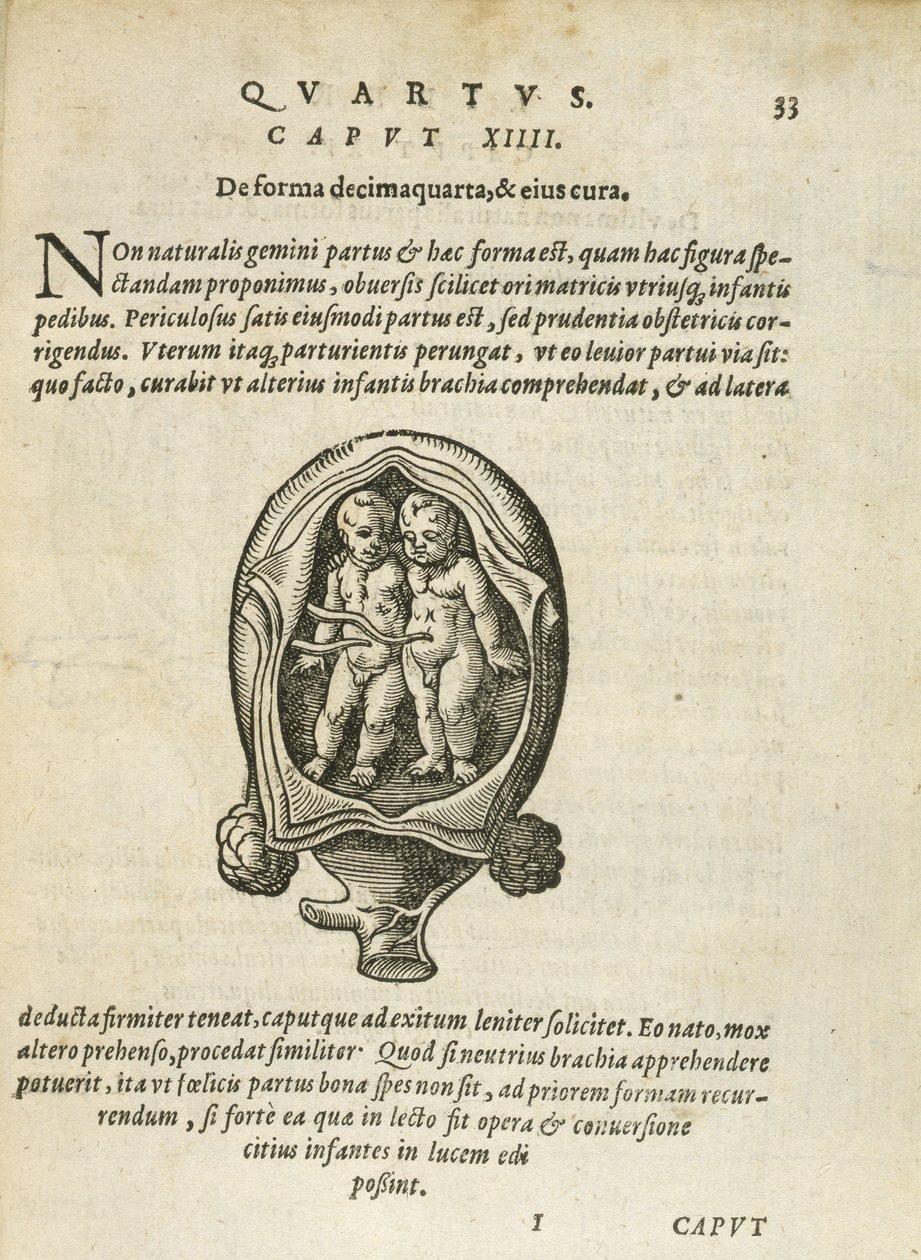 Nieidentyczne bliźnięta w łonie matki, ilustracja z rozdziału 14, księga 4 O poczęciu i rozwoju człowieka Rueffa, 1587 autorstwa German School