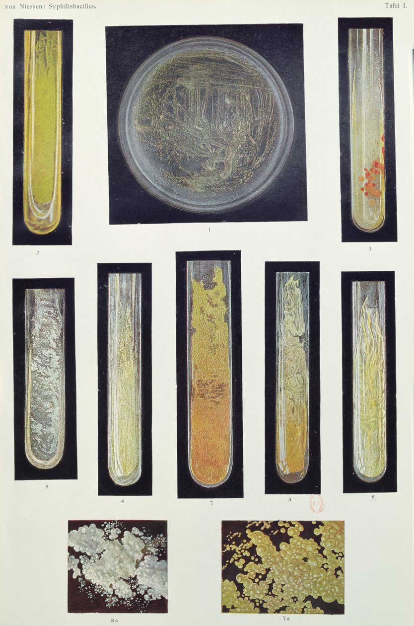 Syfilis Bacillus, z książki Maxa von Niessena, Lipsk, 1908 autorstwa German School