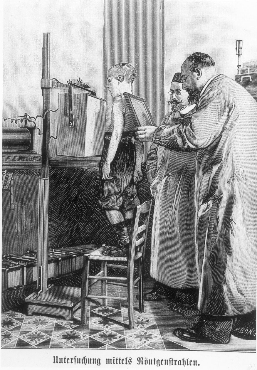 Wilhelm Konrad Roentgen (1845-1923) prześwietlający młodego chłopca, z książki Hansa Kraemera, c.1898-99 autorstwa German School