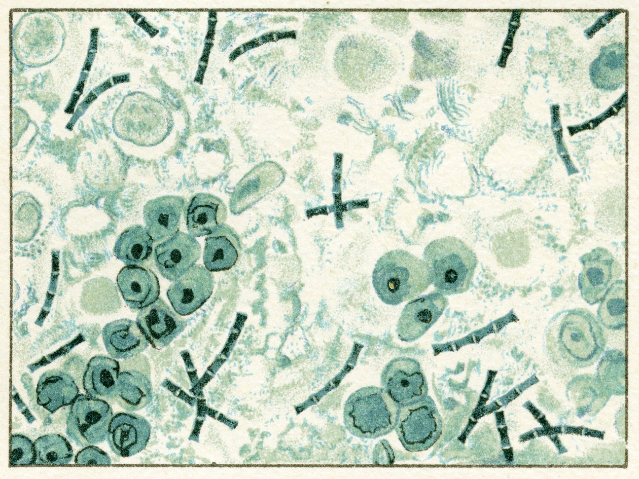 próbka bakterii wąglika we krwi ok. 1890 r. (chromolitografia kolorowa) autorstwa German School