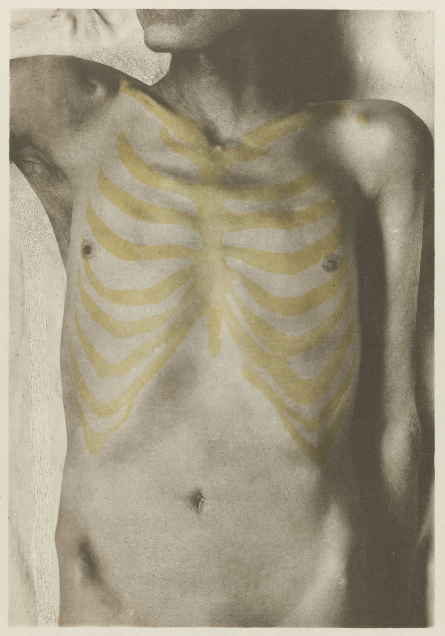Anatomiczne foto van een mannelijk lijk: 