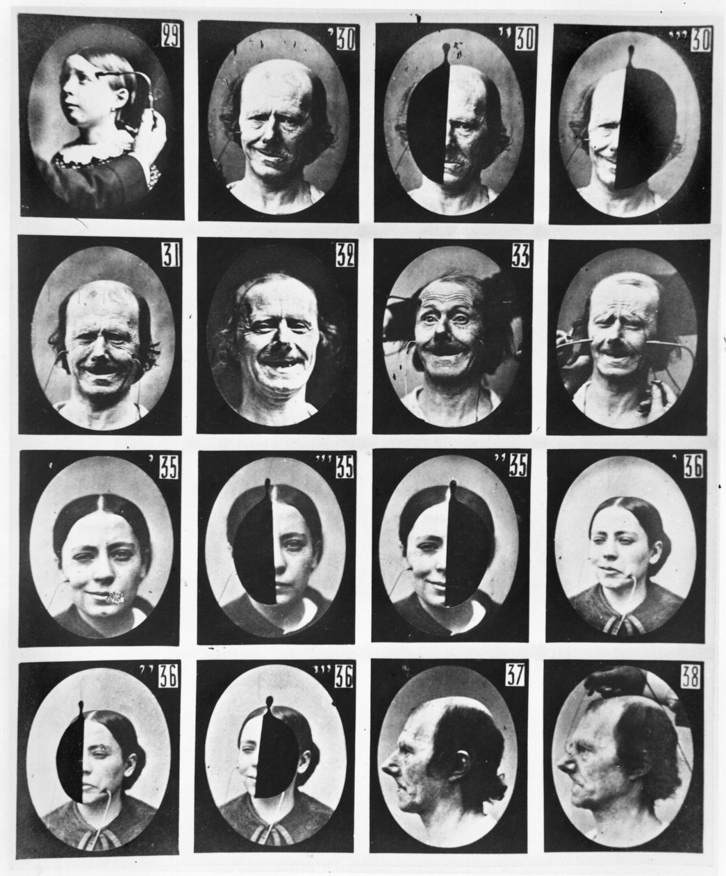 Badania fizjognomiczne, z "Mecanisme de la Physionomie humaine ou analyse electrophysiologique des passions" Duchenne de Boulogne, opublikowane 1876, Paryż. autorstwa Guillaume Benjamin Armand Duchenne de Boulogne
