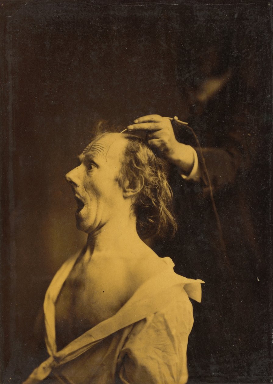 Zdumienie, osłupienie, zdumienie, 1854-1856, wydruk 1862 (zdjęcie) autorstwa Guillaume Benjamin Armand Duchenne de Boulogne