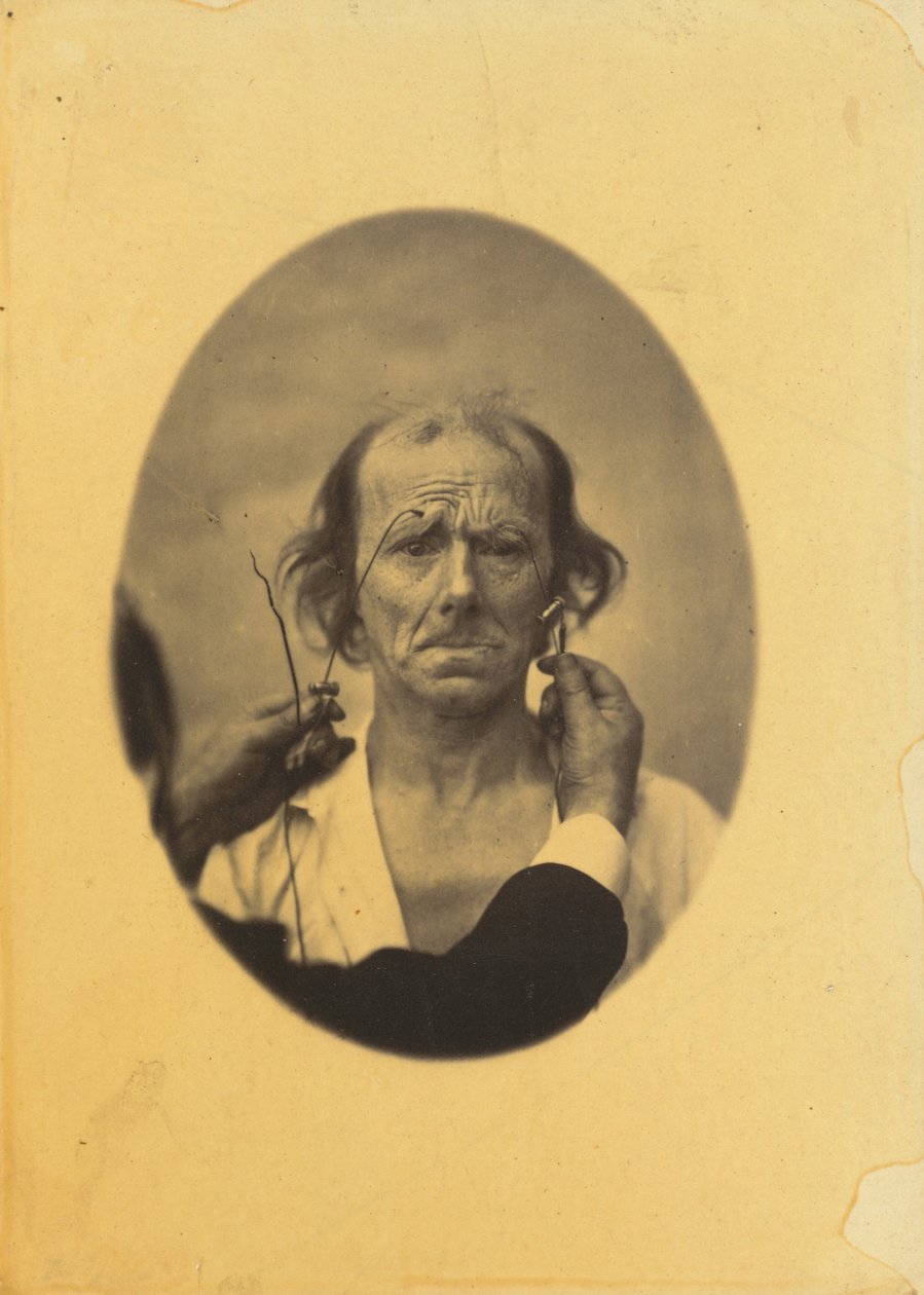 Niezadowolenie, ponure myśli (po lewej); Odbicie (po prawej) autorstwa Guillaume Benjamin Amant Duchenne
