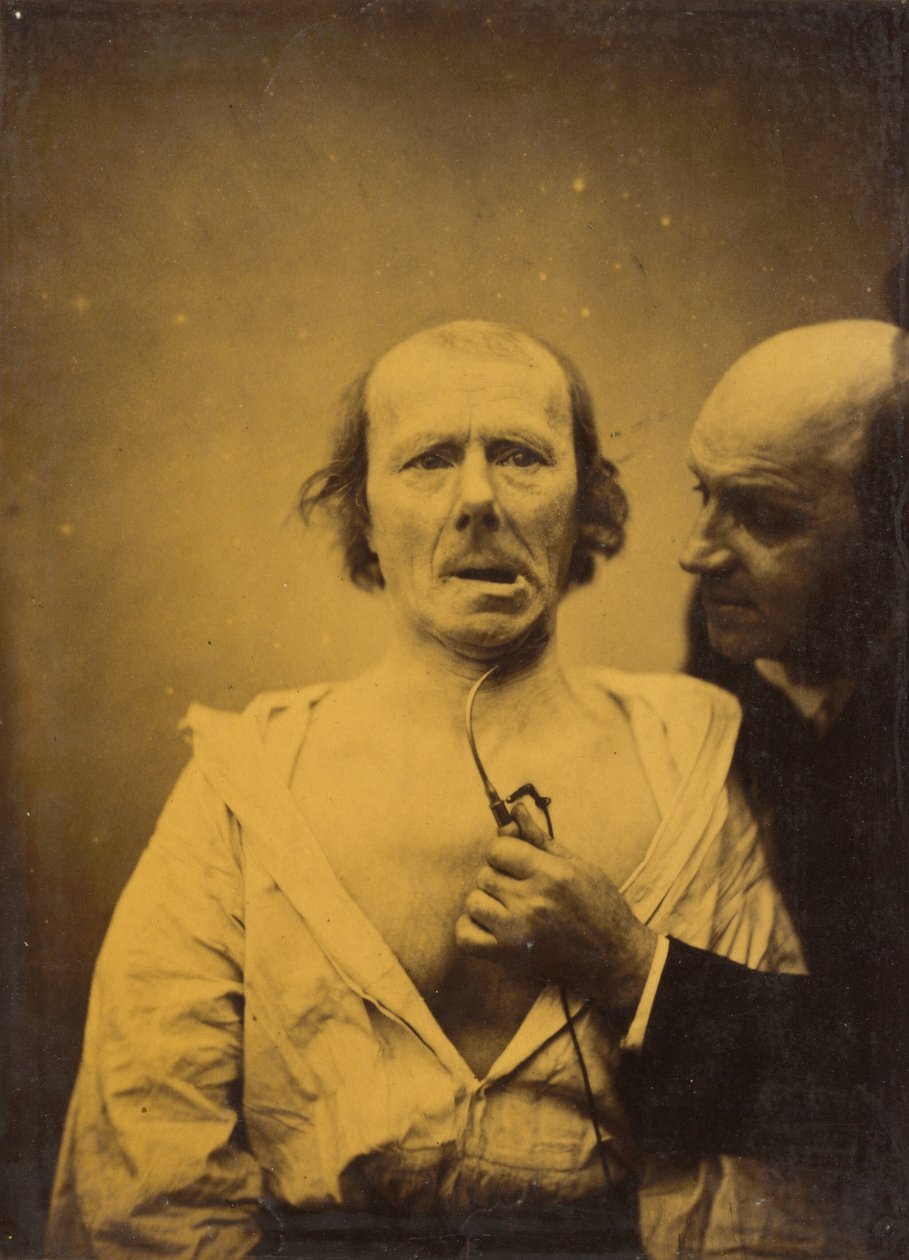 Ten skurcz m.in. sam platysma nie ma wyrazu autorstwa Guillaume Benjamin Amant Duchenne