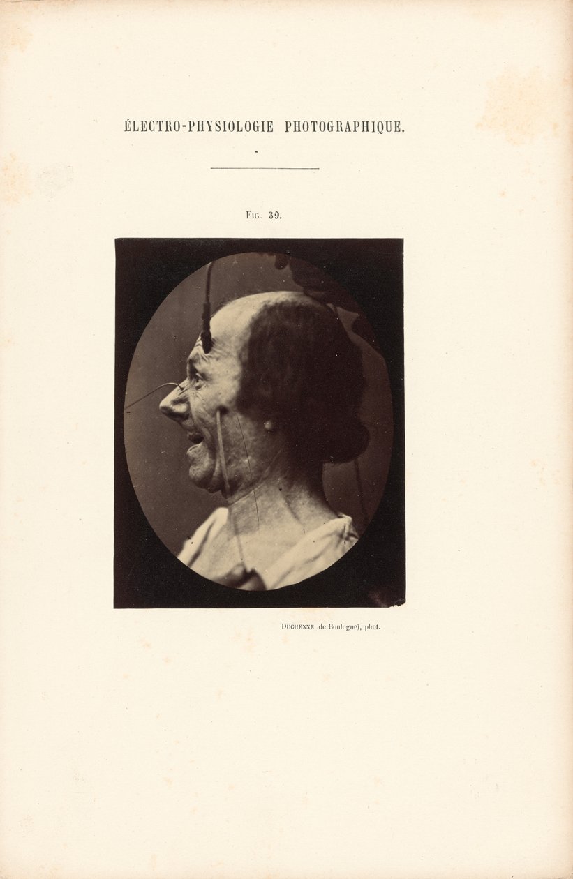 Elektrofizjologia fotograficzna, rysunek 39 autorstwa Guillaume Benjamin Duchenne