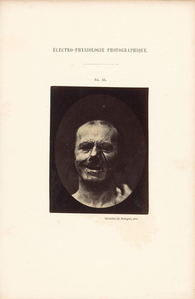 Elektrofizjologia fotograficzna, rysunek 53 autorstwa Guillaume Benjamin Duchenne