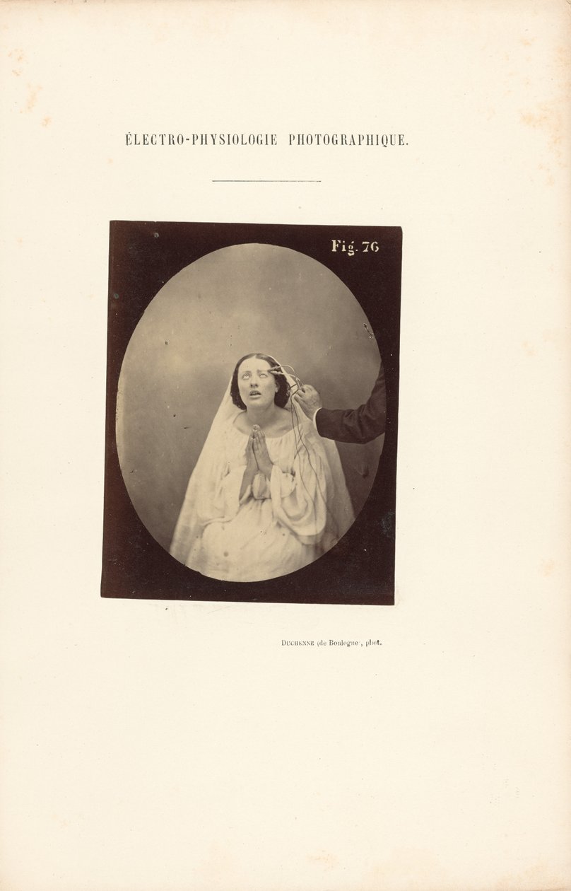 Elektrofizjologia fotograficzna, rysunek 76 autorstwa Guillaume Benjamin Duchenne