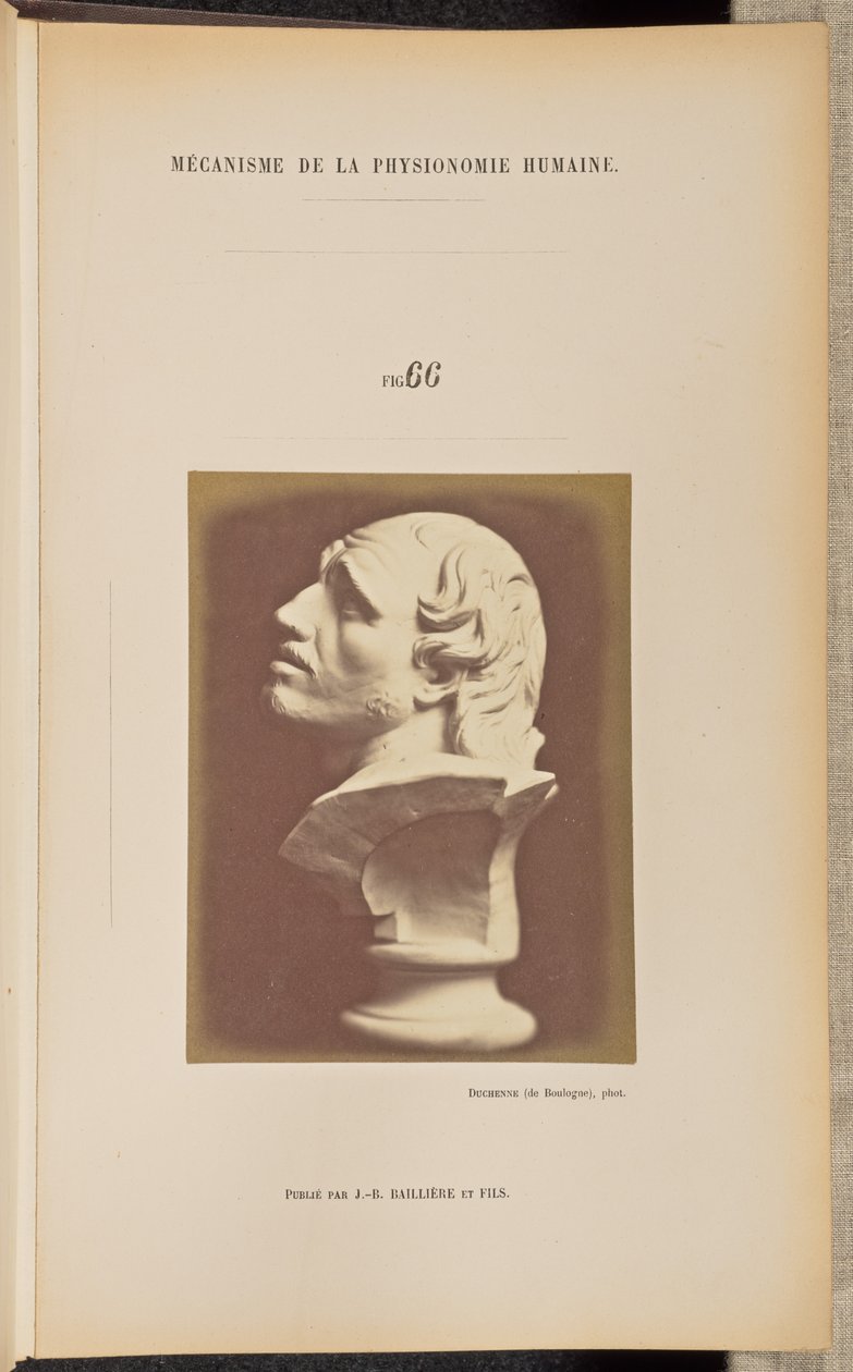 Rys. 66 autorstwa Guillaume Benjamin Duchenne