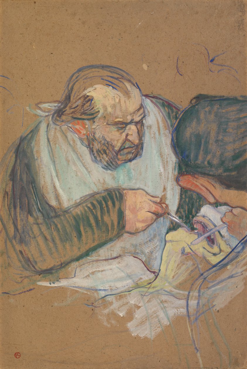 Dr Péan operujący autorstwa Henri de Toulouse-Lautrec