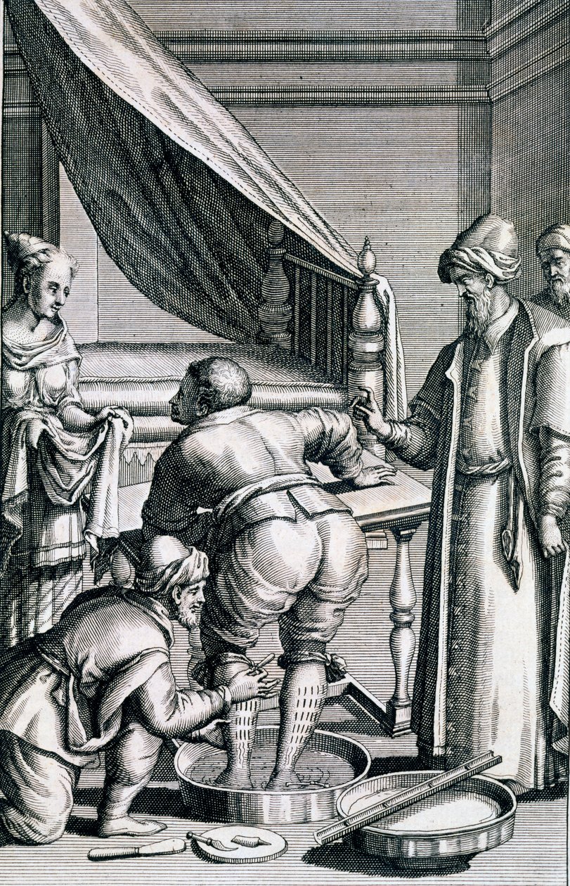 Upuszczanie krwi w nogach, z Medicina Aegyptiorum przez Prospero Alpini, opublikowane 1745 autorstwa Italian School