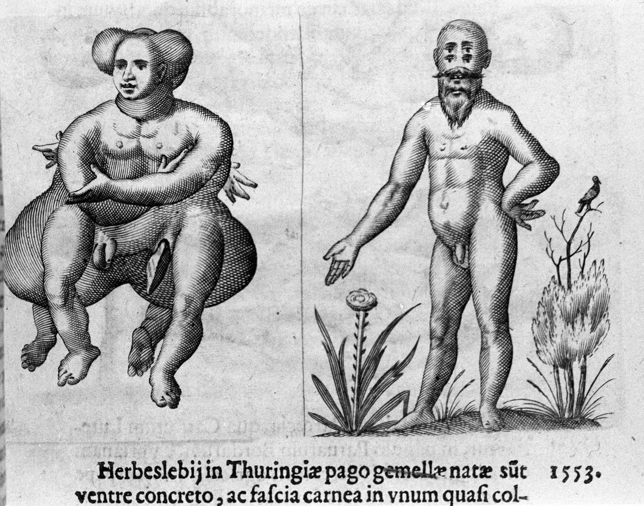 Różne rodzaje ludzkich potworów. Rycina z "Natury potworów, ich przyczyn i różnic" autorstwa włoskiego naukowca Fortunio Whilei (1577-1656). 1646 autorstwa Italian School
