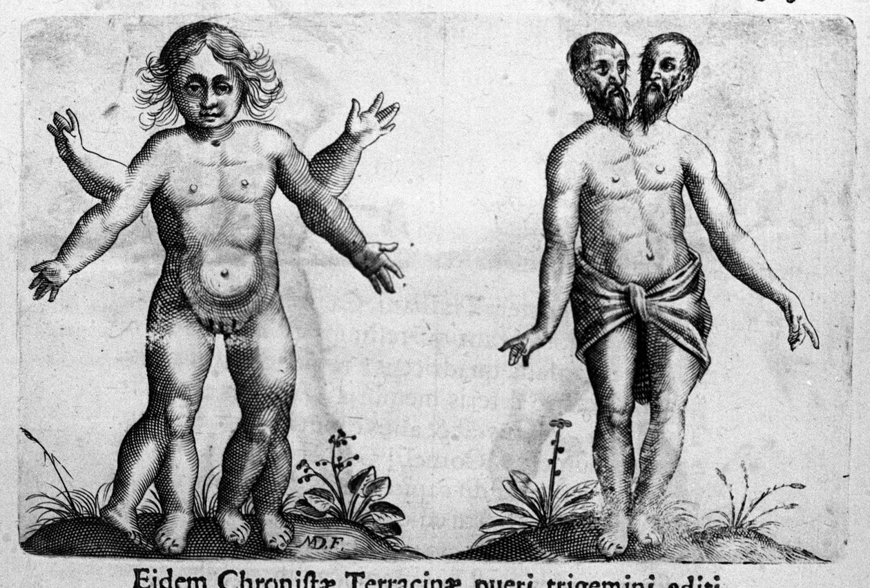 Różne typy ludzkich potworów Rycina z „Natury potworów, ich przyczyn i różnic” autorstwa Fortunio Chociaż (1577-1656), włoskiego naukowca. 1646 autorstwa Italian School