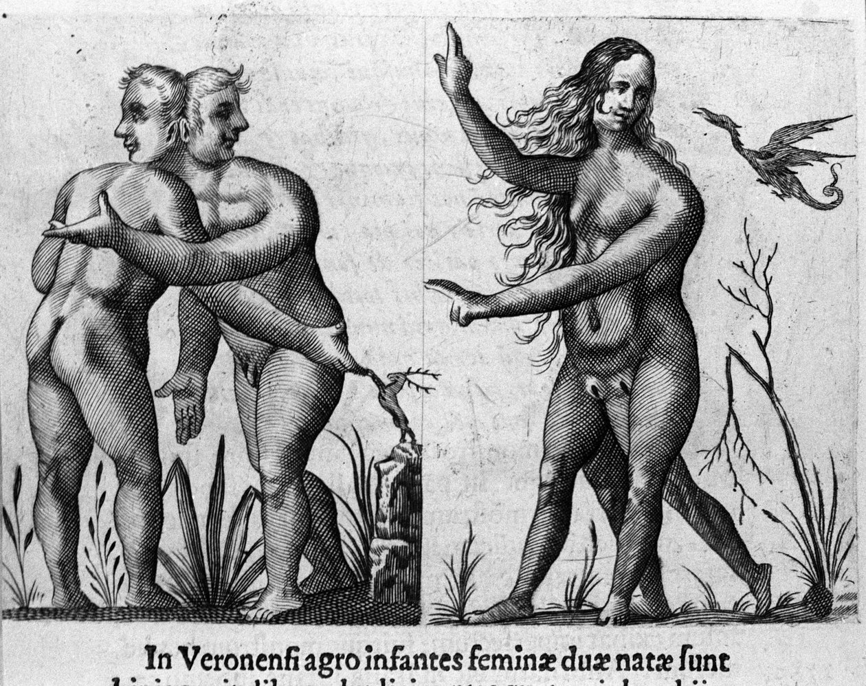 Różne typy ludzkich potworów: mężczyzna o podwójnych ciałach i głowach oraz kobieta o czterech nogach i dwóch płciach. Rycina z „De monstrorum natura, causis et differentiis” włoskiego naukowca Fortunio Liceti (1577-1656). 1646 autorstwa Italian School