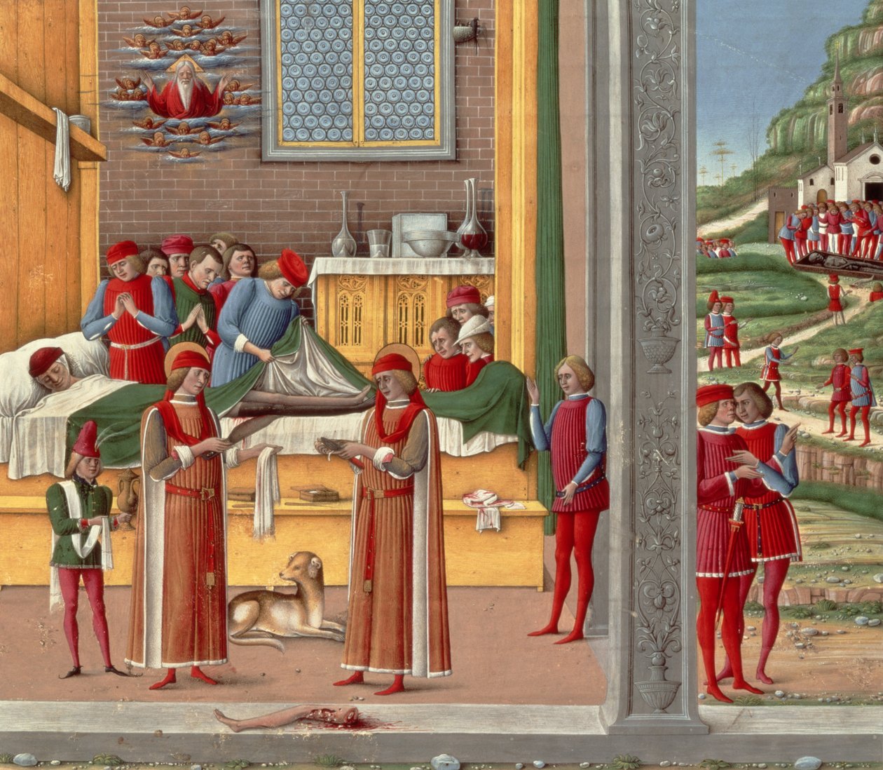 Średniowieczna scena amputacji (tempera na panelu) autorstwa Italian School