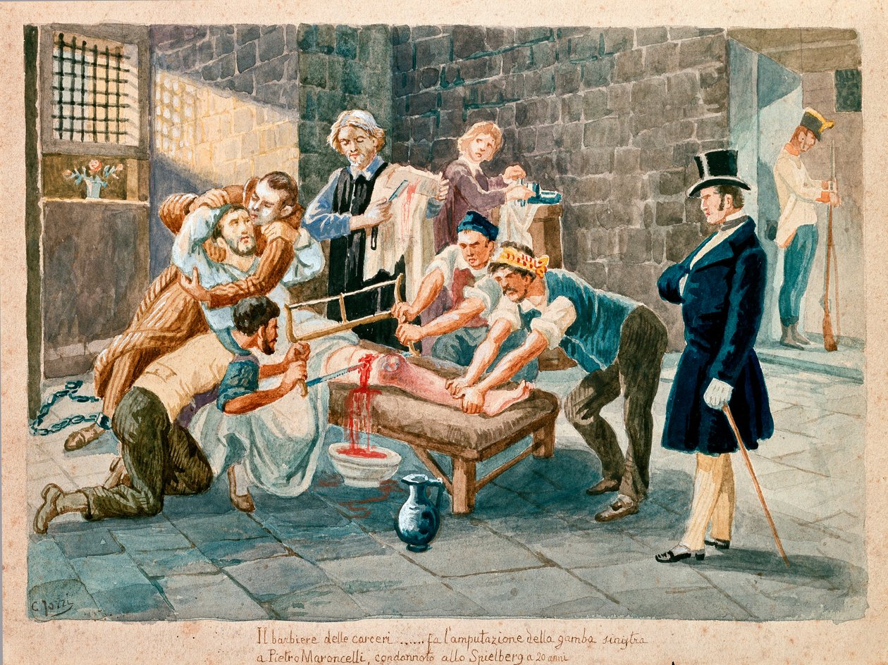 Patriota i członek Carboneria (karbonaryzmu) Pietro Maroncelli (1795-1846) został amputowany podczas pobytu w więzieniu w twierdzy Spielberg na Morawach. Grafiki z XIX-wiecznego Museo del Risorgimento, Mediolan autorstwa Italian School