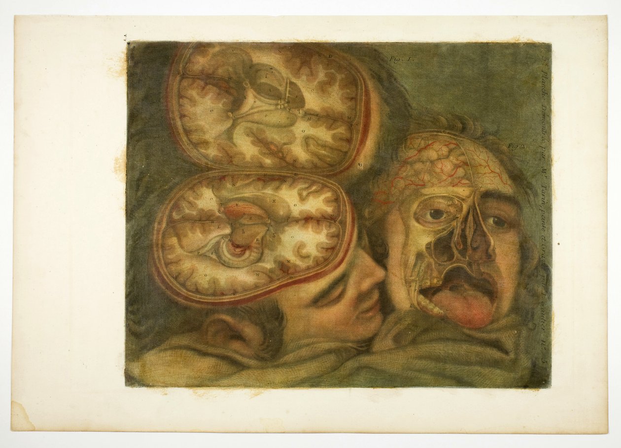 Rozwarstwienie czaszki, tablica piąta z Anatomii głowy w obrazach drukowanych autorstwa Jacques Fabien Gautier d