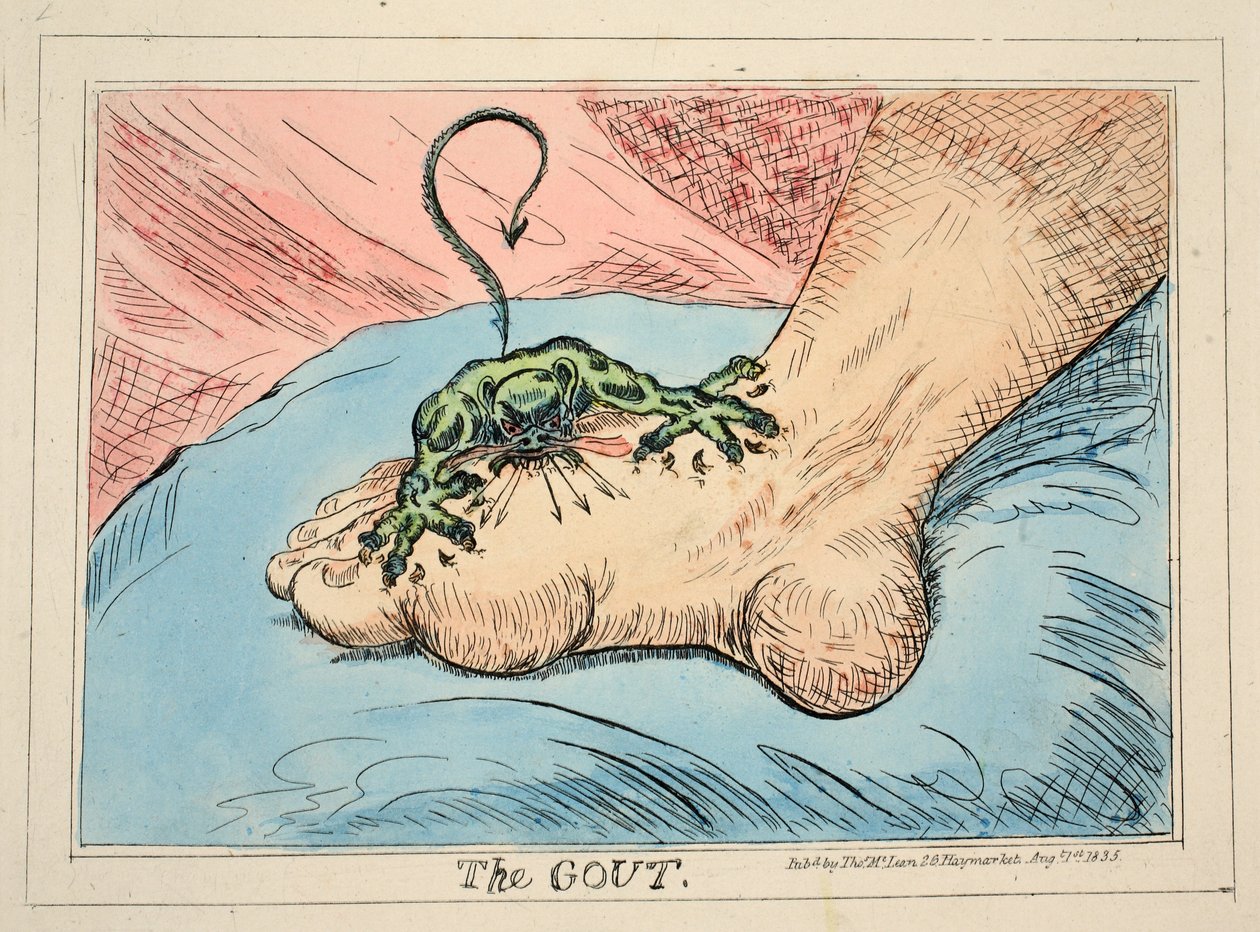 Podagra, wyd. 1835 (grawerowanie ręcznie kolorowane) autorstwa James Gillray