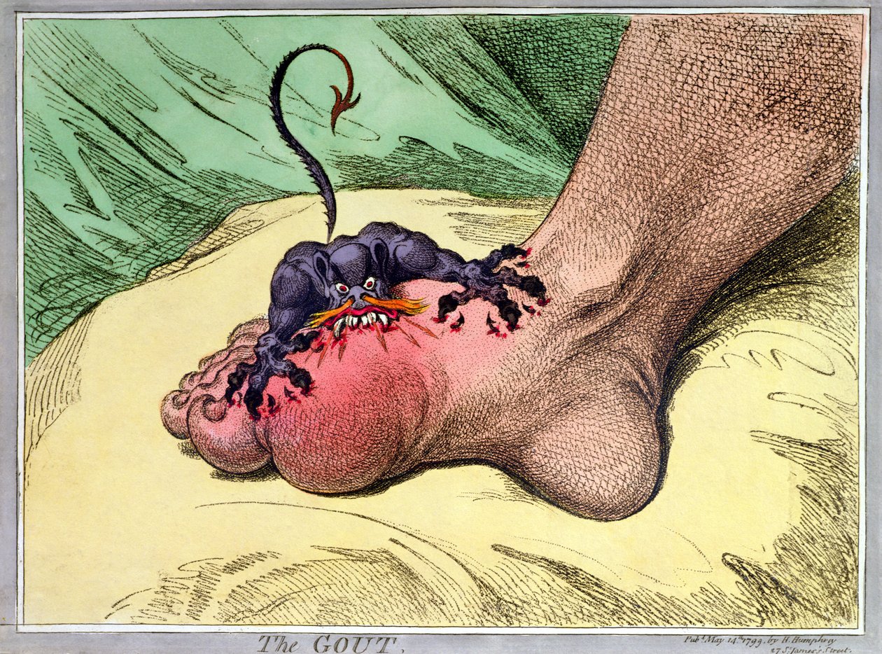 Podagra, opublikowana przez Hannah Humphrey w 1799 (ręcznie barwiona akwaforta na miękkim podłożu) autorstwa James Gillray
