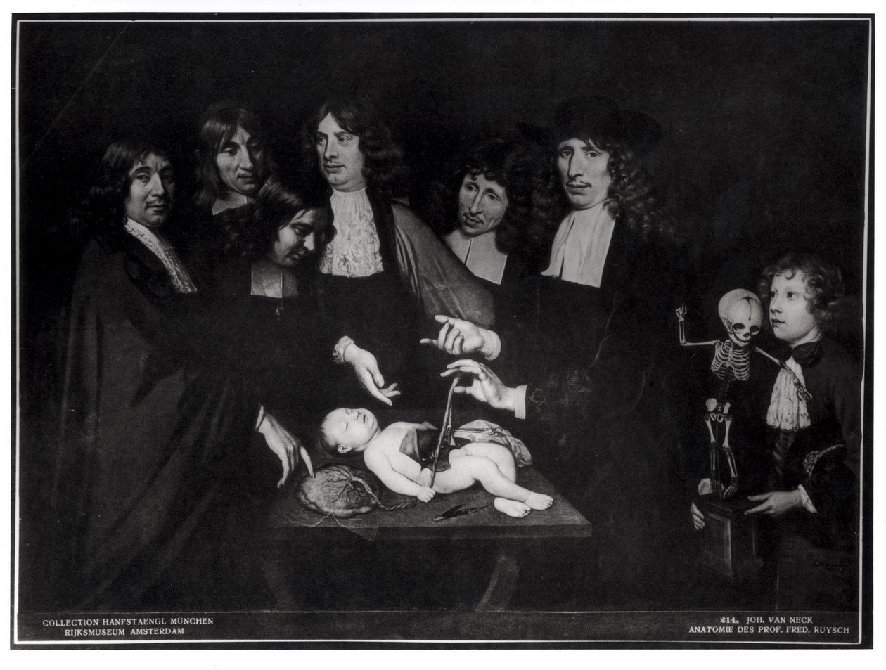 Lekcja anatomii profesora Frederika Ruyscha (1638-1731) ok. 1683 r. autorstwa Jan van Neck