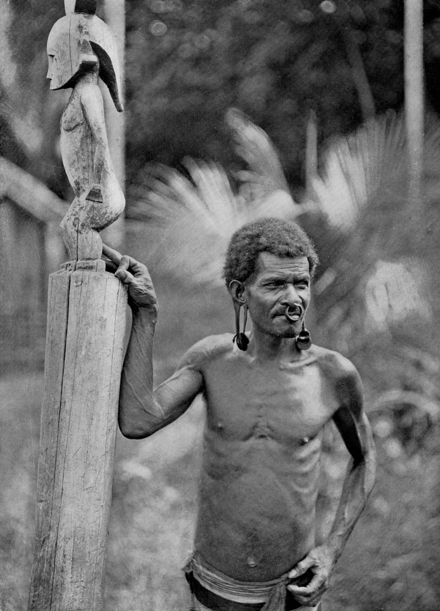 Malformacja uszu, Wyspy Salomona, 1920. autorstwa John Watt Beattie