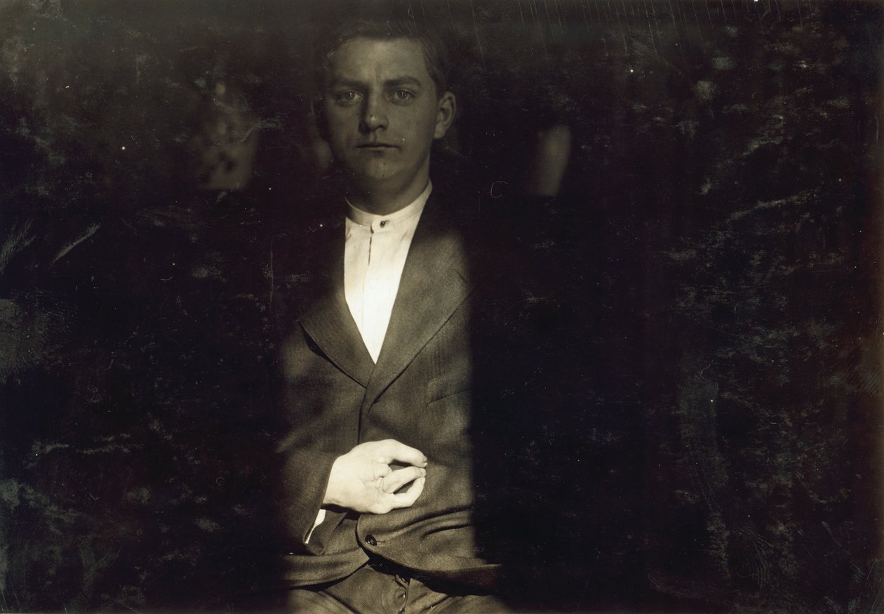 Frank Wiegel z Brooklynu, ranny po przepracowaniu 18 godzin dziennie w wieku 15 lat, amputowano mu dwa palce prawej ręki, Nowy Jork autorstwa Lewis Wickes Hine