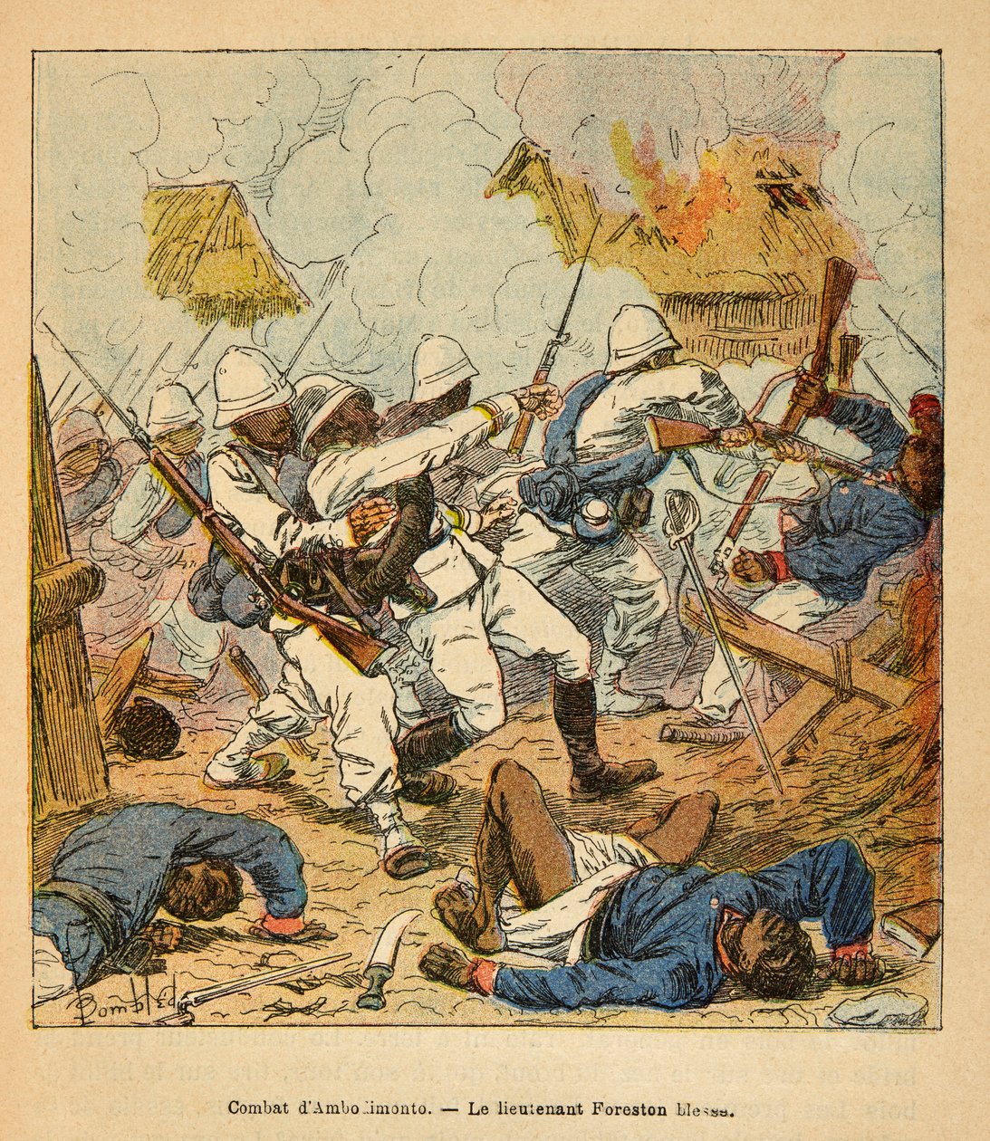 The War in Madagascar-Anecdotal History of the French Expeditions of 1885-1895 autorstwa Henri Galli dit Galllichet (1854-1922), ilustrowana przez Louis Bombled (1862-1927): Rany porucznika Forestona podczas walk pod Ambolomonty w 1895 r., kolekcja prywatn autorstwa Louis Charles Bombled