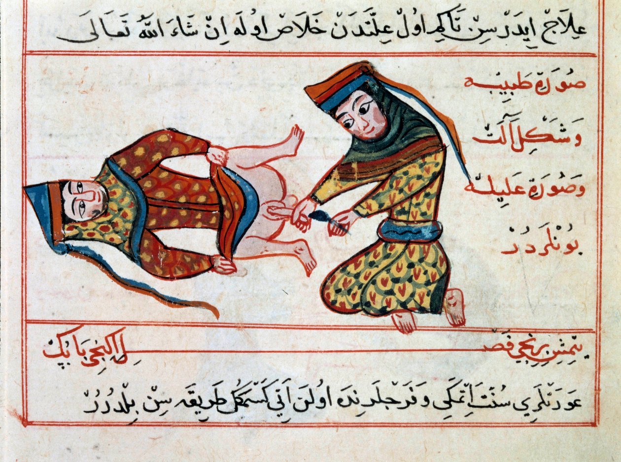 Medycyna: operacja opryszczki. Miniatura z traktatu medycyny tureckiej autorstwa Sharafa al-din autorstwa Ottoman School