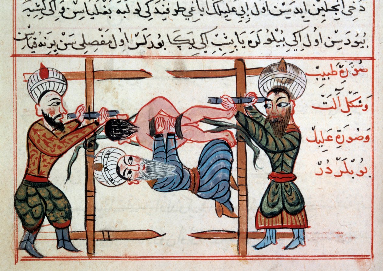 Redukcja złamania. Miniatura z traktatu medycyny tureckiej autorstwa Sharafa al-din autorstwa Ottoman School