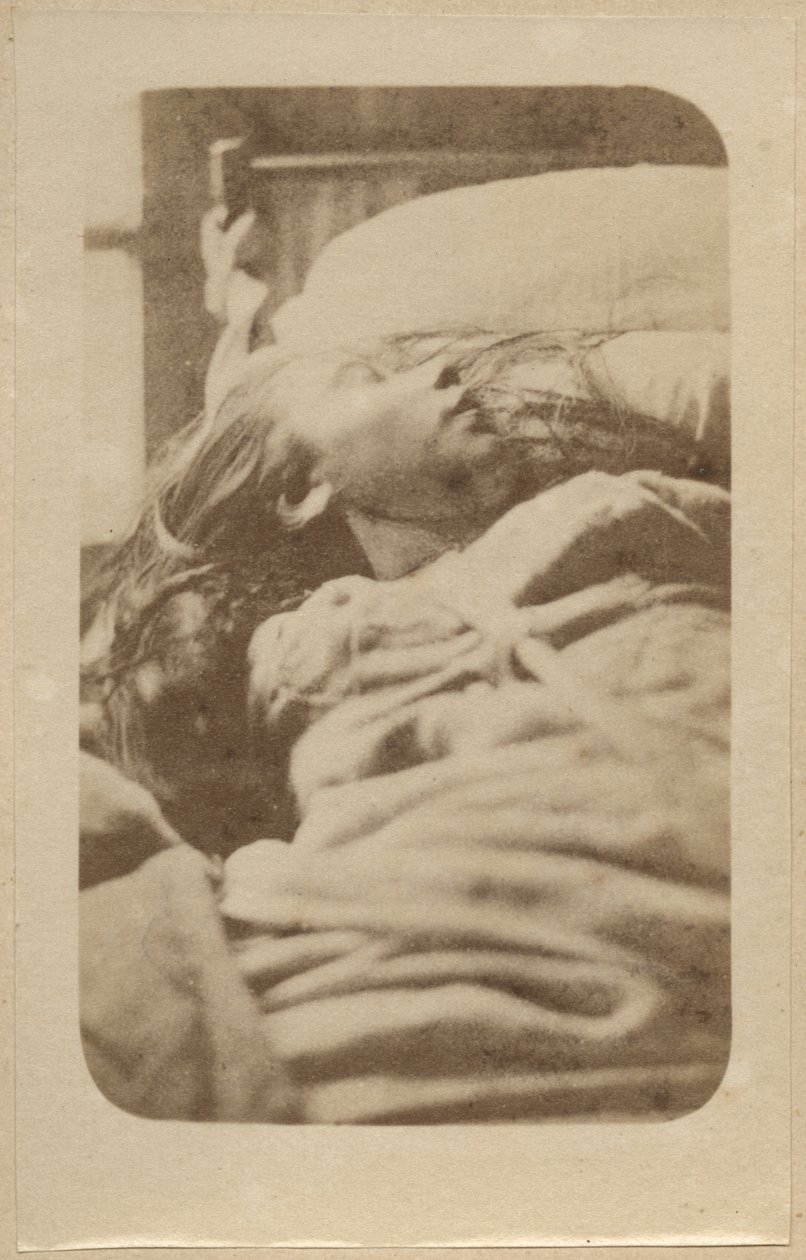 Atak histerii, faza pierwsza, ilustracja z „Iconographie Photographique de La Salpetriere” Bourneville i P. Regnard, płyta II, Paryż, 1876 (druk albumowy) autorstwa Paul Regnard