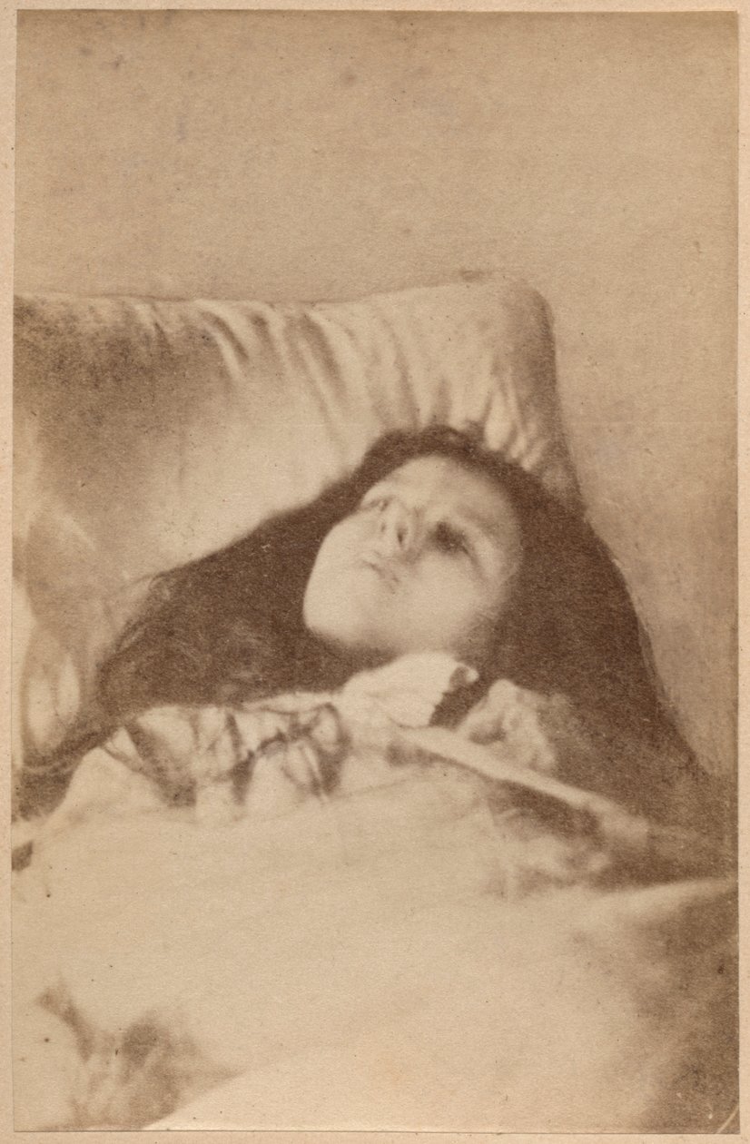Atak histerii, faza trzecia, płyta IV z „Iconographie Photographique de La Salpetriere” Bourneville i P. Regnard, Paryż, 1876 (druk albumowy) autorstwa Paul Regnard