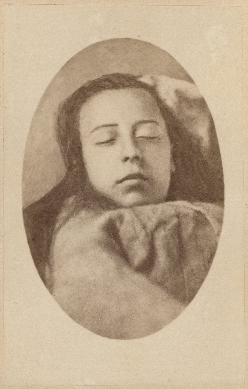 Atak histerii, faza druga, ilustracja z „Iconographie Photographique de La Salpetriere” Bourneville i P. Regnard, płyta III, Paryż, 1876 (druk albumowy) autorstwa Paul Regnard