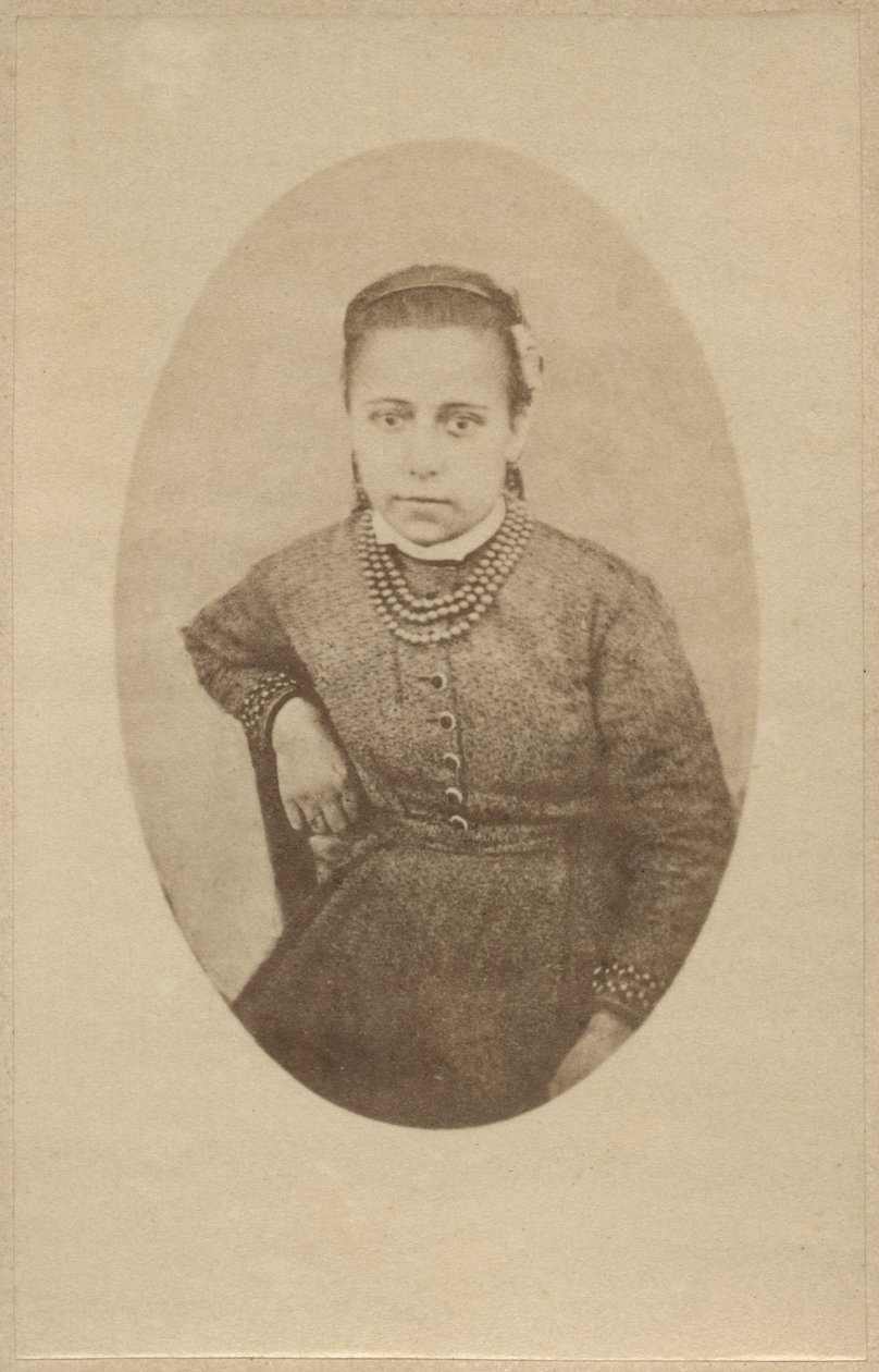 Histeria, wygląd normalny, ilustracja z „Iconographie Photographique de La Salpetriere” Bourneville