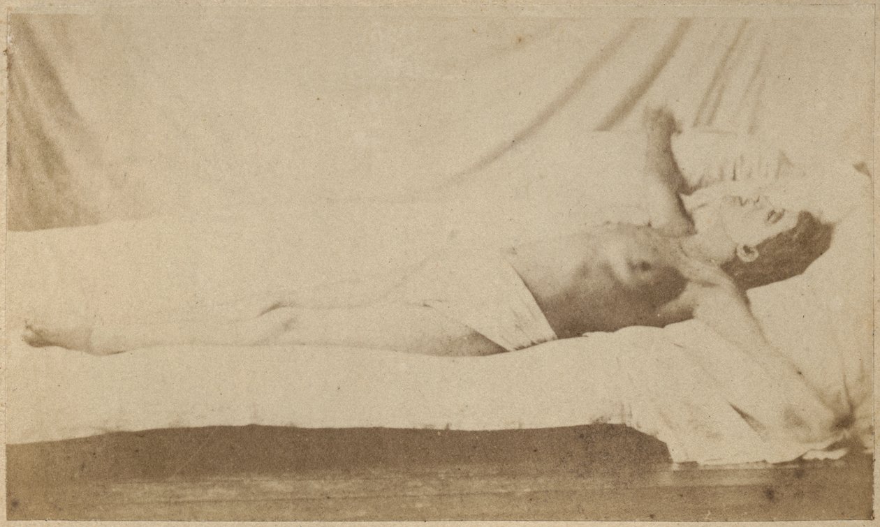 Epilepsja histeryczna, atak, ukrzyżowanie, płyta VI z "Iconographie Photographique de La Salpetriere" Bourneville et P. Regnard, Paryż, 1876 (odbitka albuminowa) autorstwa Paul Regnard
